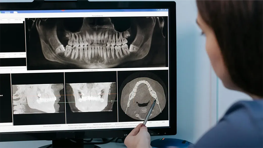 Tracing Software Orthodontie