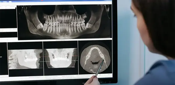 Tracing Software Orthodontie