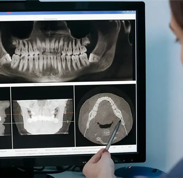 Tracing Software Orthodontie