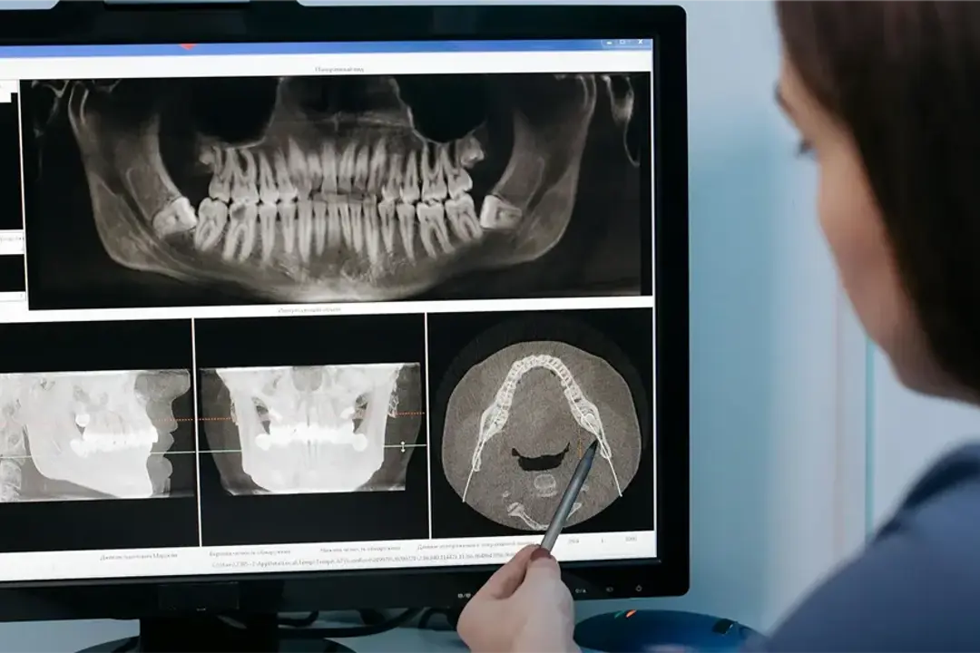 Tracing Software Orthodontie